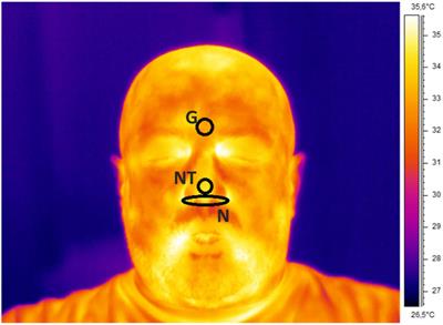 Estimation of Heart Rate Variability Parameters by Machine Learning Approaches Applied to Facial Infrared <mark class="highlighted">Thermal Imaging</mark>